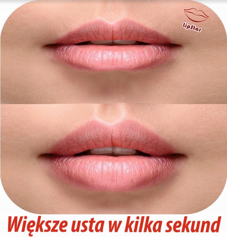 LipStar! Bezinwacyjne powiększacze do ust!
