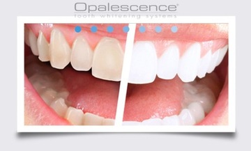 OPALESCENCE GO 1*ГОТОВЫЕ НАКЛАДКИ ОТБЕЛИВАЮЩИЙ ГЕЛЬ