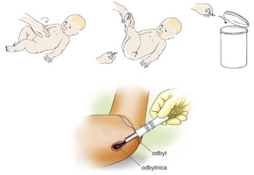 КАТЕТЕР ВИНДИ РЕКТАЛЬНЫЙ ПУТЬ К КОЛИКАЛЬНОЙ БОЛИ В ЖИВОТЕ GAAS FRIDABABY