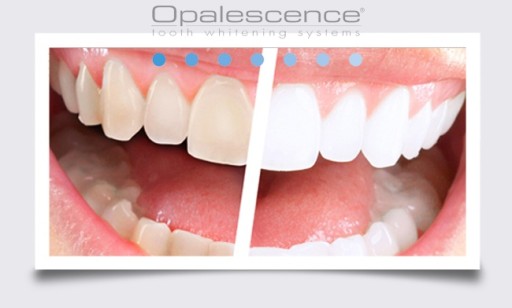 OPALESCENCE GO 1x набор Отбеливание зубов США