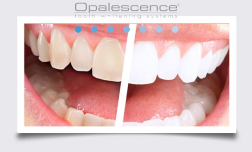 OPALESCENCE WHITENING PASTE_TEOTH WHITENING США